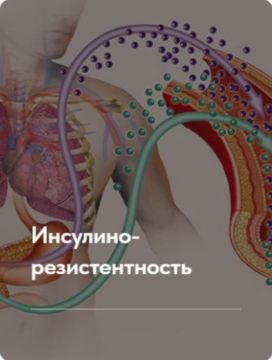 Елена Ержанова Лечебный протокол «Инсулинорезистентность».Тариф без обратной связи 2023 слив курса