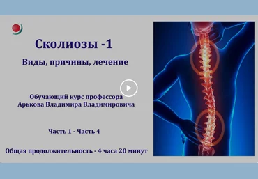 Владимир Арьков Сколиозы - 1. Виды, причины, лечение 2023 слив