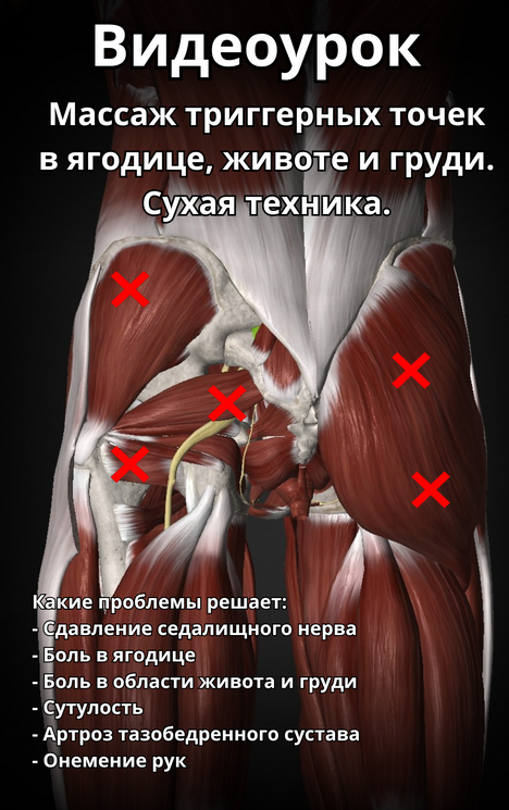 Артем Пак Массаж триггерных точек в ягодице, животе и груди 2024 слив курса