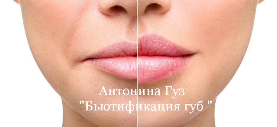 Антонина Гуз Бьютификация губ 2023 слив курса