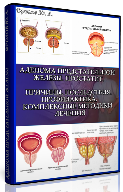 Мини инфопродукт №4 «Аденома предстательной железы. Простатит. Причины. Последствия. Профилактика слив курса