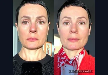 Анна Ахметшина Красота и омоложение 2019 скачать слив