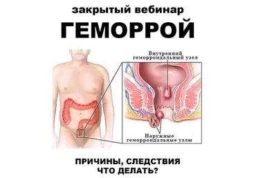 pravda.pro.pisheprom Женя Братишка, Юля Братишка ― Геморрой 2024 слив