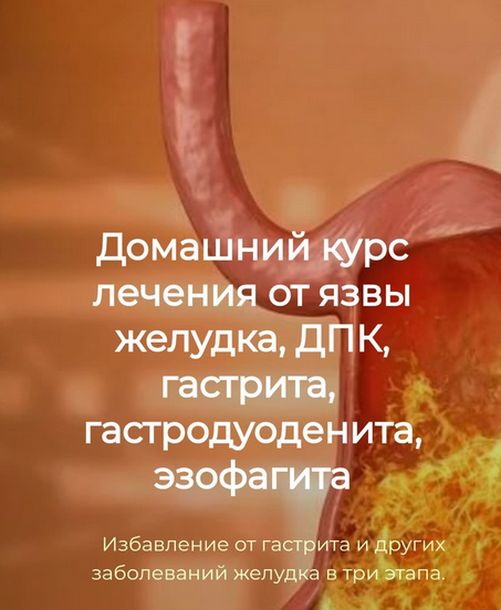 Игорь Кауфман Домашний курс лечения от язвы желудка, ДПК, гастрита 2024 слив курса