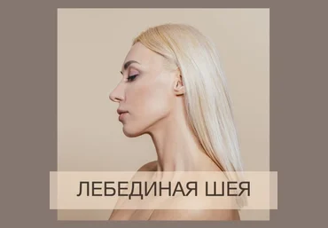 Дерюгина - Лебединая шея слив