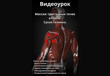 Артём Пак Массаж триггерных точек в плече 2024 слив