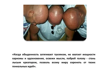 Виктор Орлов - Лысая харизма слив
