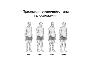 Доктор Эрик Берг Печеночный тип телосложения 2021 слив