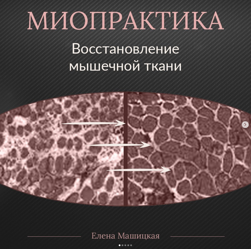 Елена Машицкая Миопрактика 2.0 2022 слив курса