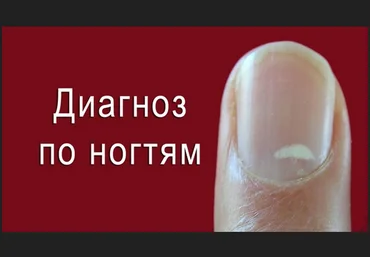 Анна Шутова Диагностика по ногтям 2021 слив
