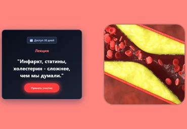 Валерий Подрубаев Humberto 2.0 Инфаркт, статины, холестерин - сложнее, чем мы думали 2025 слив