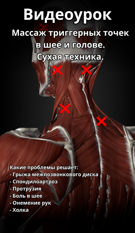 Артем Пак Массаж триггерных точек в шее и голове 2024 слив курса