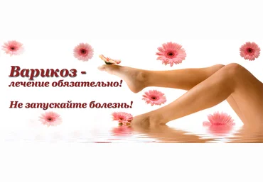 Варикозное расширение вен. Геморрой. - Жгарёва слив
